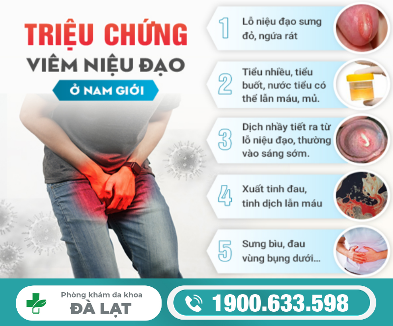 Hình ảnh minh họa